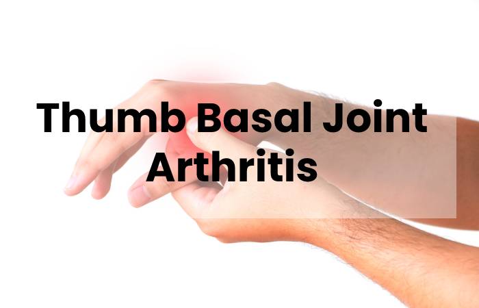 Thumb Basal Joint Arthritis And The Anchovy Procedure 2022 3441